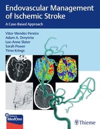 Produktbild: Endovascular Management of Ischemic Stroke