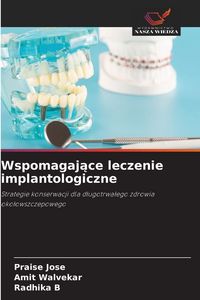 Produktbild: Wspomagaj&iquest;ce leczenie implantologiczne