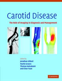 Produktbild: Carotid Disease