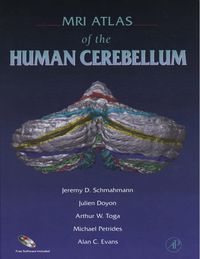 Produktbild: MRI Atlas of the Human Cerebellum