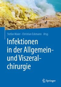 Produktbild: Infektionen in der Allgemein- und Viszeralchirurgie