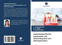 Produktbild: Implantatoberfl&auml;chen- topographie und Osseointegration von Zahnimplantaten