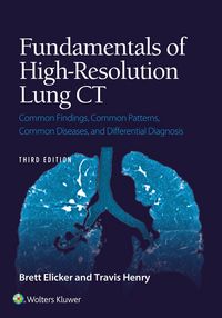 Produktbild: Fundamentals of High-Resolution Lung CT