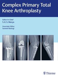 Produktbild: Complex Primary Total Knee Arthroplasty
