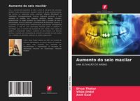 Produktbild: Aumento do seio maxilar