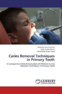 Produktbild: Kochhar, G: Caries Removal Techniques in Primary Teeth
