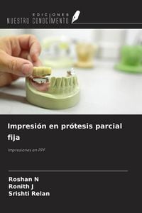 Produktbild: Impresi&oacute;n en pr&oacute;tesis parcial fija