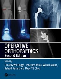 Produktbild: Operative Orthopaedics