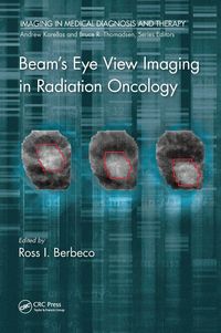 Produktbild: Beam's Eye View Imaging in Radiation Oncology