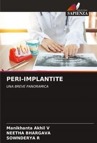 Produktbild: Peri-Implantite