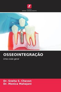 Produktbild: Osseointegra&ccedil;&atilde;o