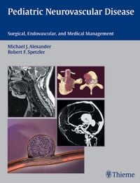 Produktbild: Pediatric Neurovascular Disease