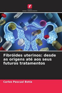 Produktbild: Fibr&oacute;ides uterinos: desde as origens at&eacute; aos seus futuros tratamentos
