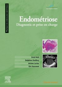 Produktbild: Endom&eacute;triose : diagnostic et prise en charge