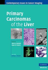 Produktbild: Primary Carcinomas of the Liver