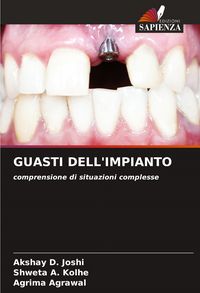 Produktbild: Guasti Dell'impianto