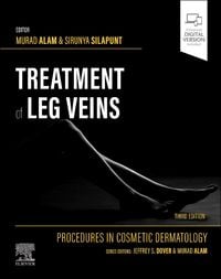 Produktbild: Procedures in Cosmetic Dermatology Series: Treatment of Leg Veins