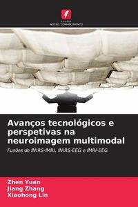 Produktbild: Avan&ccedil;os tecnol&oacute;gicos e perspetivas na neuroimagem multimodal