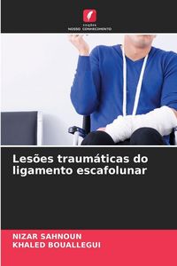 Produktbild: Les&otilde;es traum&aacute;ticas do ligamento escafolunar