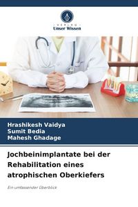 Produktbild: Jochbeinimplantate bei der Rehabilitation eines atrophischen Oberkiefers