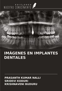 Produktbild: Im&aacute;genes En Implantes Dentales
