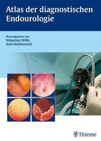 Produktbild: Atlas der diagnostischen Endourologie