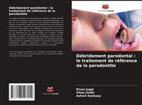 Produktbild: D&eacute;bridement parodontal : le traitement de r&eacute;f&eacute;rence de la parodontite