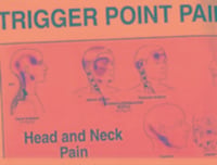 Produktbild: Travell, J: Travell and Simons' Trigger Point Pain Patterns