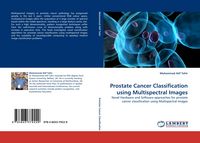 Produktbild: Prostate Cancer Classification using Multispectral Images