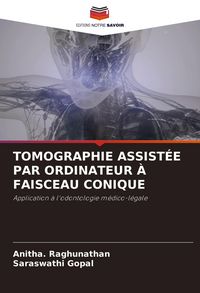 Produktbild: Tomographie Assist&eacute;e Par Ordinateur &Agrave; Faisceau Conique