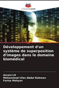 Produktbild: D&eacute;veloppement d'un syst&egrave;me de superposition d'images dans le domaine biom&eacute;dical