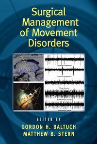Produktbild: Surgical Management of Movement Disorders