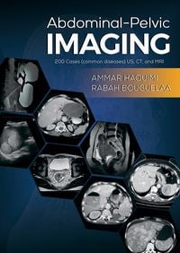 Produktbild: Abdominal-Pelvic Imaging