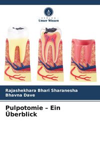 Produktbild: Pulpotomie - Ein &Uuml;berblick