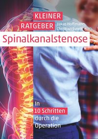 Produktbild: Kleiner Ratgeber Spinalkanalstenose