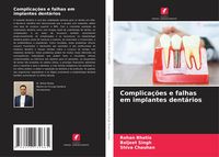 Produktbild: Complica&ccedil;&otilde;es e falhas em implantes dent&aacute;rios