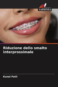 Produktbild: Riduzione dello smalto interprossimale