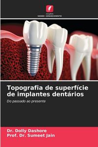 Produktbild: Topografia de superf&iacute;cie de implantes dent&aacute;rios