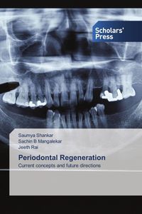 Produktbild: Periodontal Regeneration