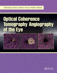 Produktbild: Optical Coherence Tomography Angiography of the Eye