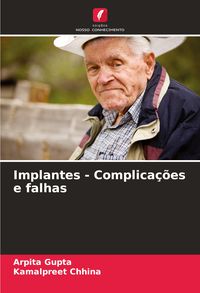 Produktbild: Implantes - Complica&ccedil;&otilde;es e falhas