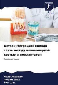 Produktbild: Osteointegraciq: edinaq swqz' mezhdu al'weolqrnoj kost'&uuml; i implantatom