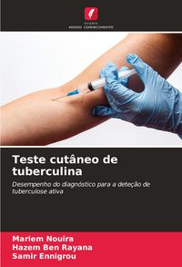 Produktbild: Teste cut&acirc;neo de tuberculina