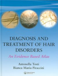 Produktbild: Tosti, A: Diagnosis and Treatment of Hair Disorders