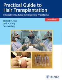 Produktbild: Practical Guide to Hair Transplantation