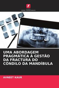 Produktbild: Uma Abordagem Pragm&aacute;tica &Agrave; Gest&atilde;o Da Fractura Do C&ocirc;ndilo Da Mand&iacute;bula