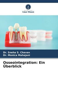 Produktbild: Osseointegration: Ein &Uuml;berblick
