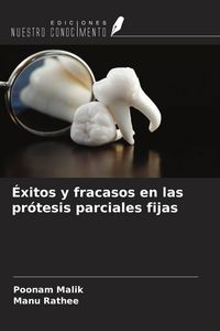 Produktbild: &Eacute;xitos y fracasos en las pr&oacute;tesis parciales fijas