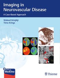 Produktbild: Imaging in Neurovascular Disease