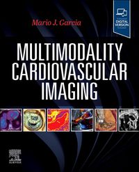 Produktbild: Multimodality Cardiovascular Imaging